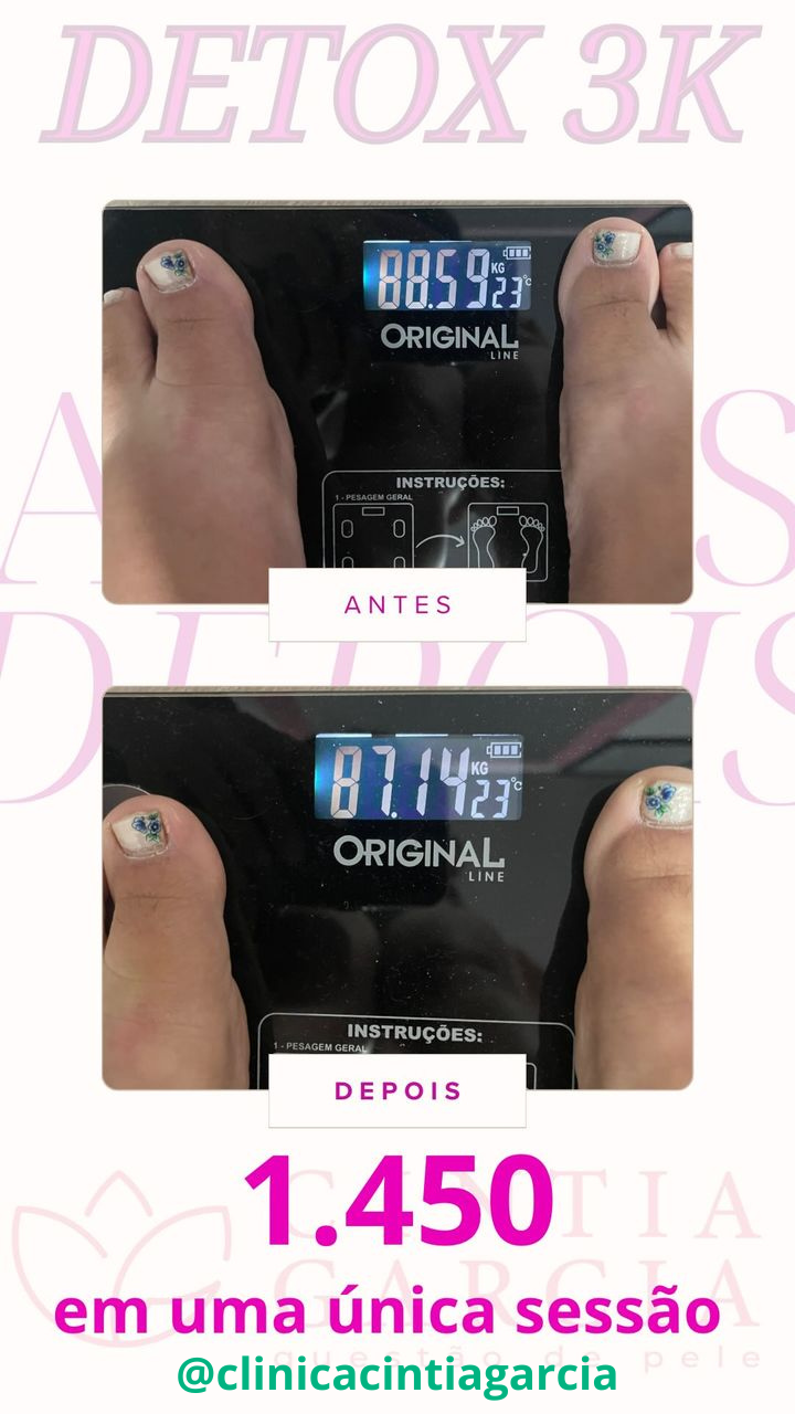 Antes e depois com o DETOX 3K