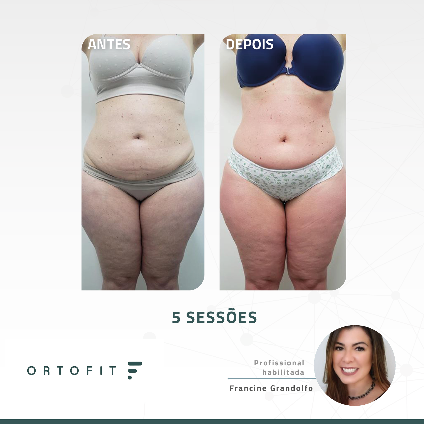 Antes e depois com o DETOX 3K