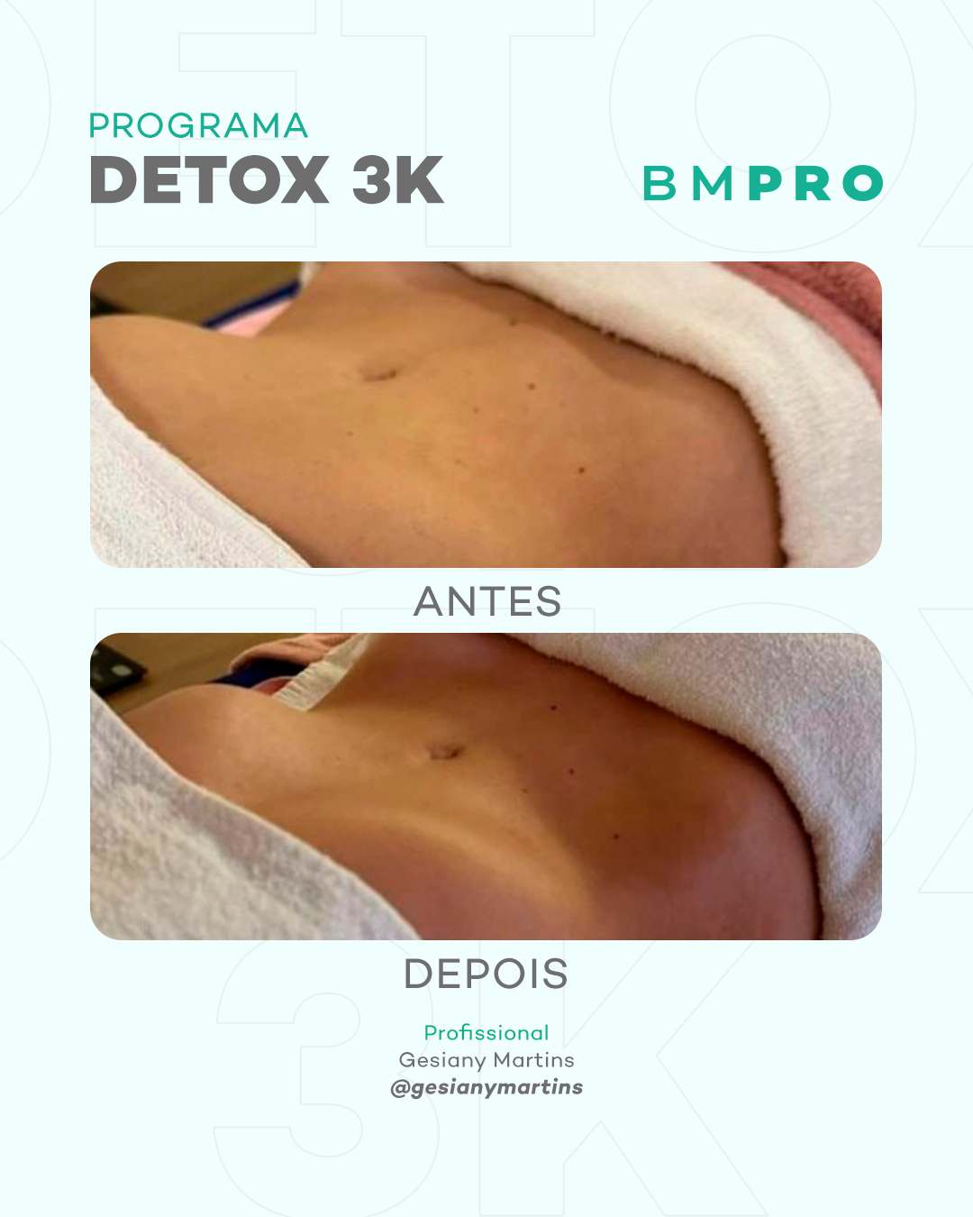 Antes e depois do abdômen com o DETOX 3K — profissional Gesiany Martins (@gesianymartins)